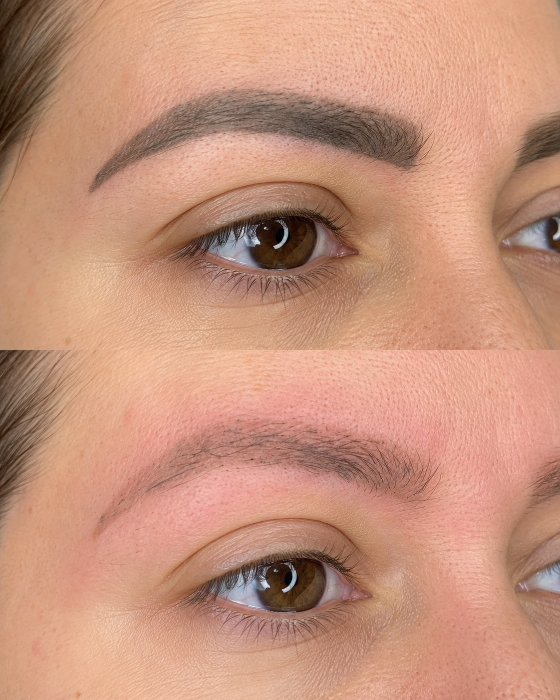 Advanced 1-Day Laser Removal Course