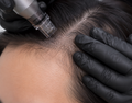 Advanced 1-Day Scalp Pigmentation Course
