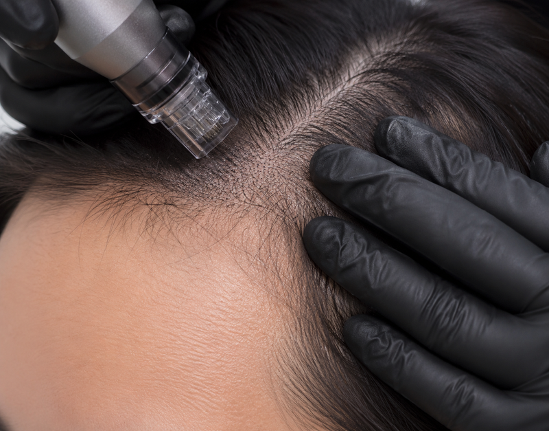 Advanced 1-Day Scalp Pigmentation Course